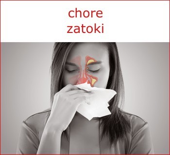 Chore zatoki